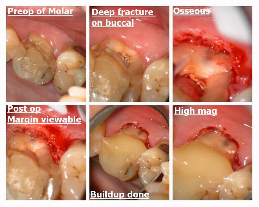 Resize of page 1 of osseous.jpg